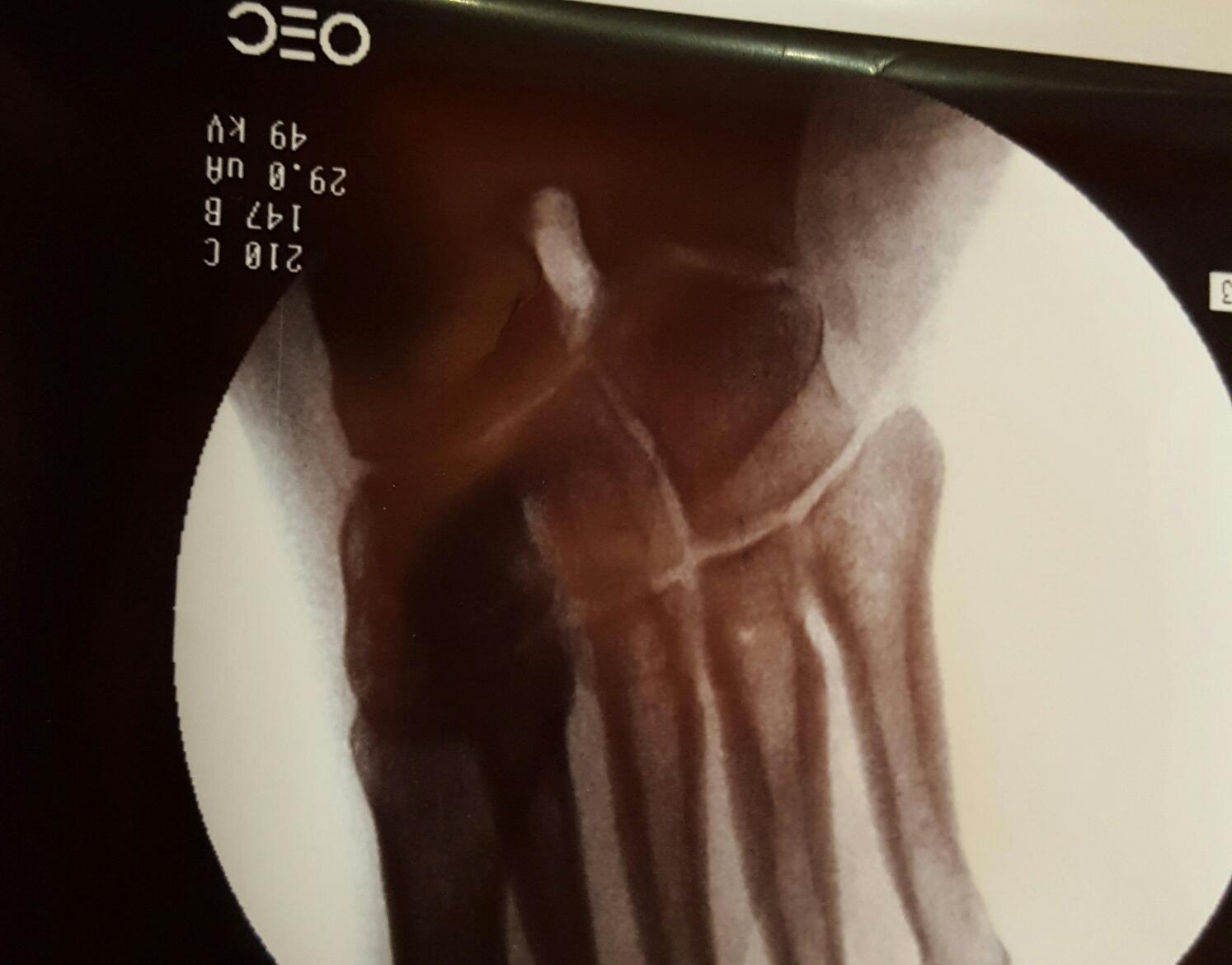 Resized_20170411_115300